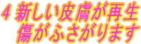4img